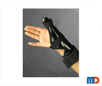 Thumb Spica Splint