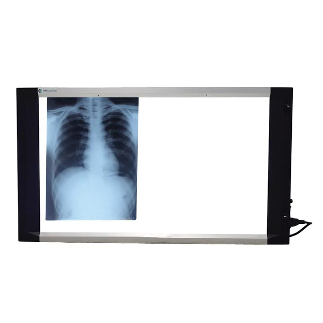 Slim LED X Ray View Box (25mm Thickness) With Dimmer & Sensor - Double Film